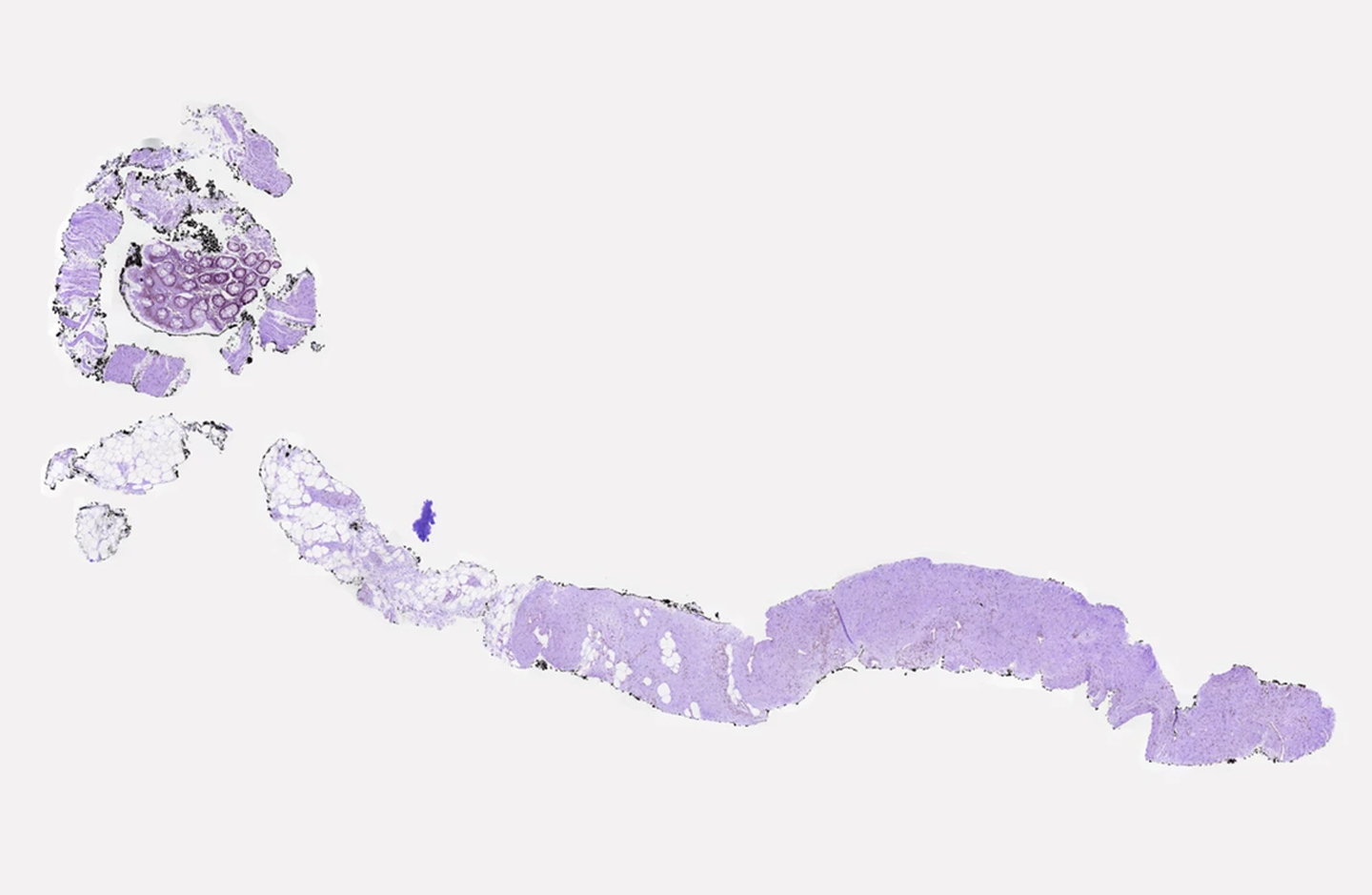 On a tongue’s tip, at a world’s lip